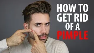 6 Ways to Get Rid of Pimples Fast